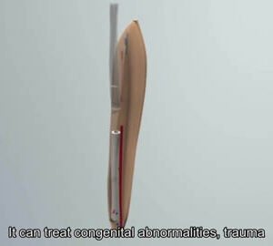 The Reconstructive Microsurgery Miracle-Worker: Dr. Wei Fu-chan / 奇蹟人物：魏福全醫生（英文版）