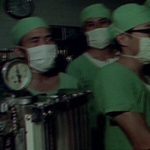 臺灣第一例連體嬰分割手術前練習