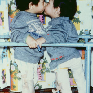 連體嬰外科手術-MOFA109179CF-2020-12-SL00018-046