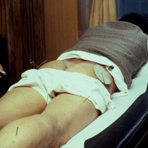 針灸-MOFA109179CF-2020-12--SL00023-018