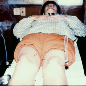 針灸-MOFA109179CF-2020-12--SL00023-029